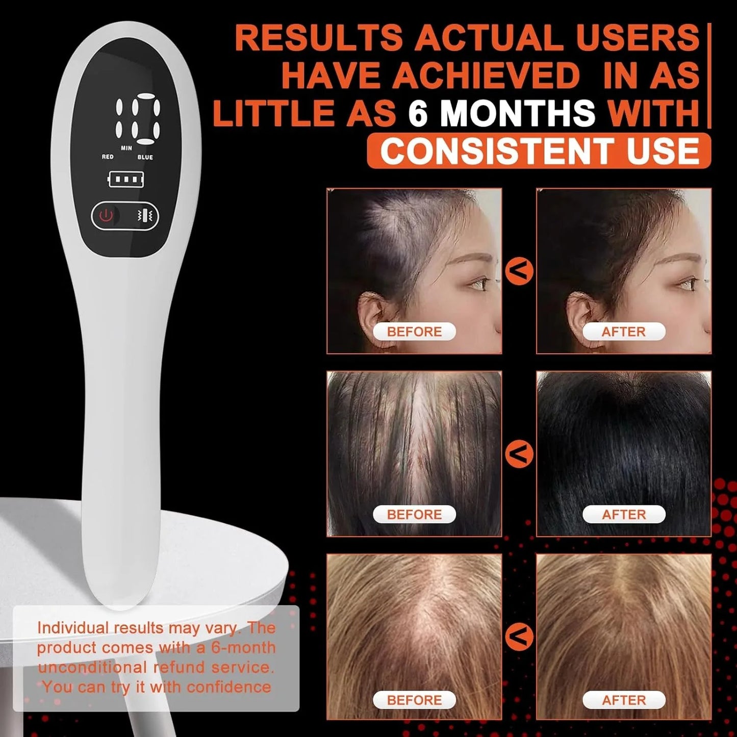 Hign Concerned Electric Laser Hair Growth Comb LED Therapy